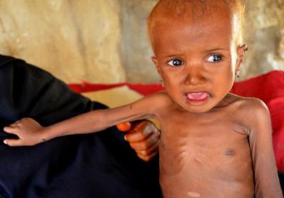 منظمة دولية : 50 ألف طفل يمني مهددون بالوفاة بسبب "الجوع والمرض"