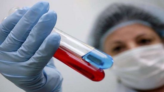 علماء: أدوية السرطان قد تعالج مرضى الإيدز!