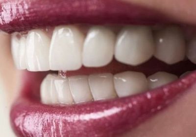 الأسنان البيضاء لا تعني بالضرورة أنها صحية