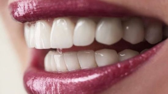 الأسنان البيضاء لا تعني بالضرورة أنها صحية