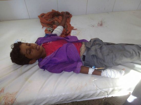 اصابة طفلين برصاص قناصة لمليشيا الحوثي جنوب حيفان بتعز