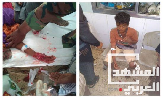 إصابة طفلين برصاص قناصة مليشياالحوثي في حيفان بـ #تعز