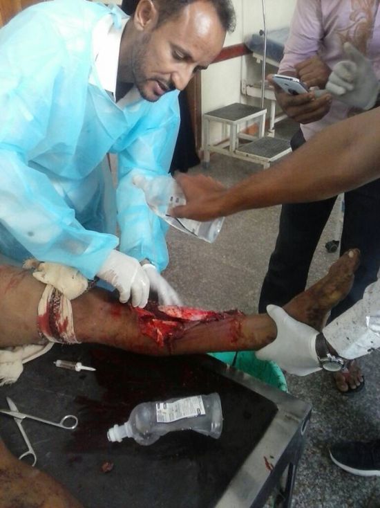 نجاة مدير مستشفى المخا من كمين نصبته مليشيا الحوثي شمال يختل