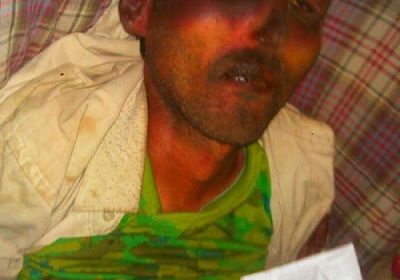 وفاة مختطف تحت التعذيب في سجون الحوثيين بمدينة دمت بالضالع 