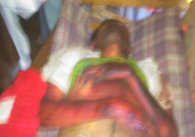  مقتل مواطن  تحت التعذيب في سجن  الحوثيين بمدينة إب 