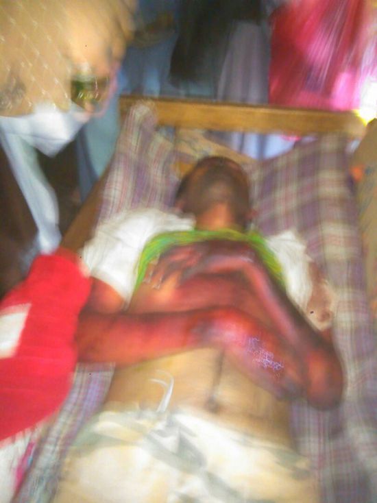  مقتل مواطن  تحت التعذيب في سجن  الحوثيين بمدينة إب 