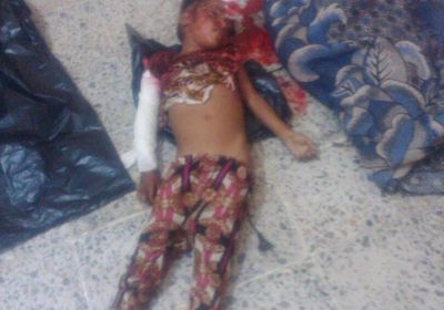إستشهاد «5» مدنيين واصابة «3» اخرين في قصف مدفعي للحوثيين على الخوخة 