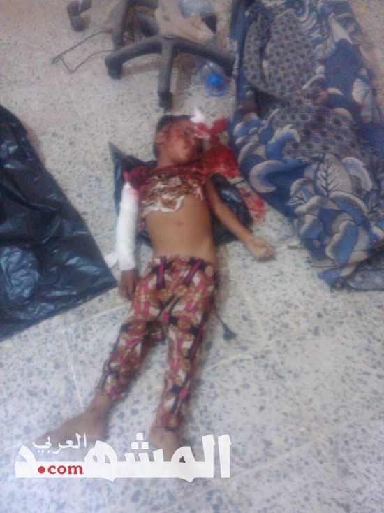 إستشهاد «5» مدنيين واصابة «3» اخرين في قصف مدفعي للحوثيين على الخوخة 