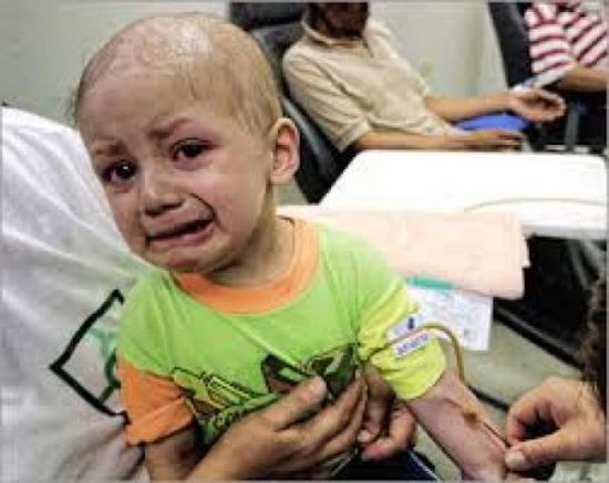 «30» ألف حالة سرطان سنويا في اليمن