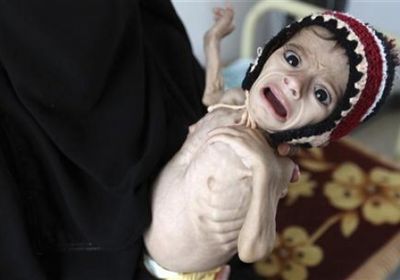 الأمم المتحدة تعلن تخصيص 9.1 مليون دولار لدعم الاحتياجات الصحية العاجلة في اليمن
