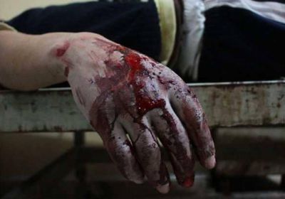 البيت الأبيض: يد روسيا ملوثة بدماء المدنيين في الغوطة