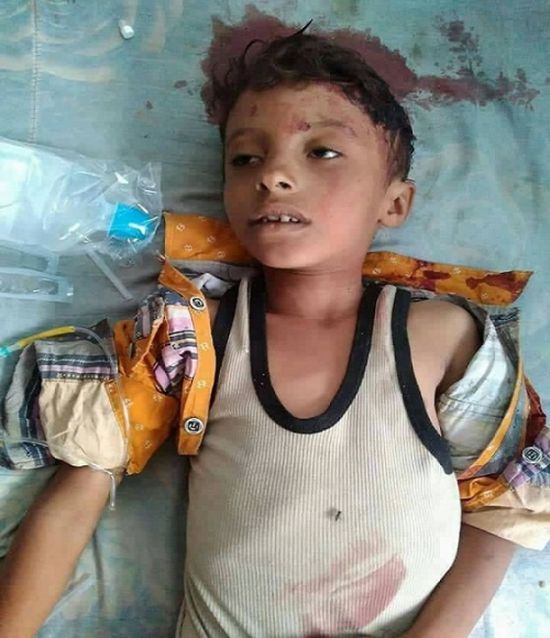 مقتل طفل في التاسعة من عمره برصاص قناص حوثي في طور الباحة 