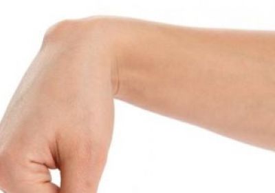 علاج الكيس الدهني في اليد عن طريق شفط الدهون