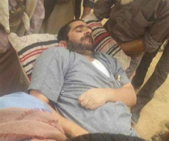صور.. مختطف يصاب بـ " شلل تام " جراء التعذيب بسجون الحوثي