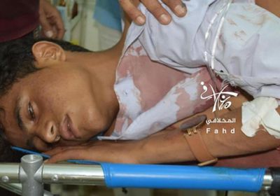 صور مرعبة.. أطفال ضحايا قصف حوثي لحي سكني بتعز