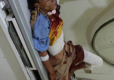 إصابة 3 أطفال بقذائف مليشيات الحوثي غرب مريس