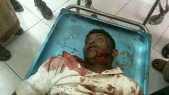 مقتل شاب تخطى مشرف حوثي بدراجته النارية في الحديدة 