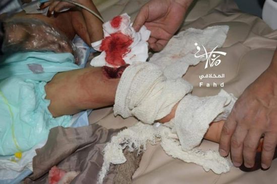 إصابة مدنيين اثنين بانفجار عبوة ناسفة وسط تعز