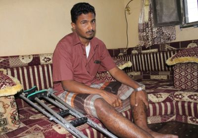 «الهلال الاماراتي » تعيد الأمل لشاب يمني من ضحايا ألغام الحوثي