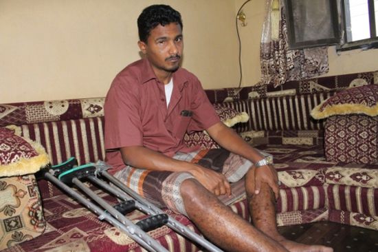 «الهلال الاماراتي » تعيد الأمل لشاب يمني من ضحايا ألغام الحوثي