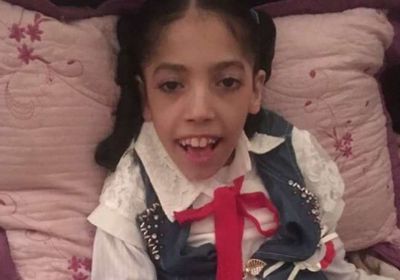 قصة شيماء.. الطفلة اليمنية التي شغلت إعلام أميركا