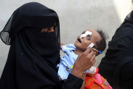 الصحّة العالمية لازال اليمن تحت طائلة الكوليرا 