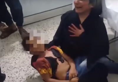قذيفة حوثية تحرق قلب أم على طفلتها في تعز (فيديو)
