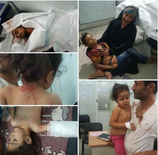 «صورة».. الحوثيون يرفضون علاج الأطفال