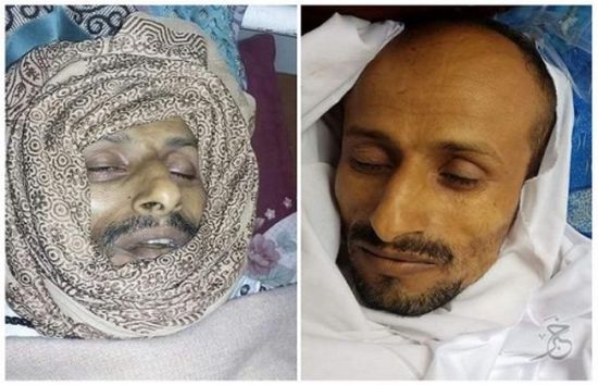 وفاة مواطن جراء تعرضه للتعذيب في أحد سجون مليشيا الحوثي في إب