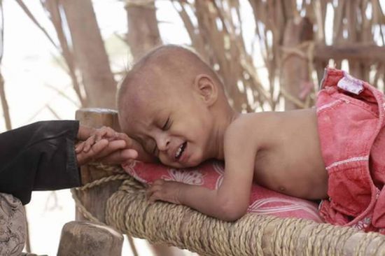 المديرة التنفيذية لليونيسف : "طفلا واحدا في اليمن يموت كل 10 دقائق من مرض يمكن الوقاية منه"،