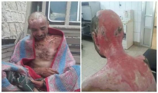 صورة.. بطريقة وحشية الحوثيون يعذبون دكتور بصنعاء 