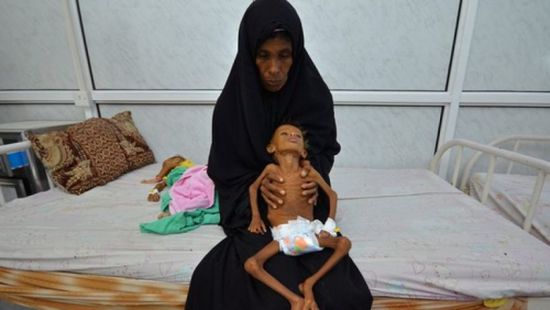 «يونيسف»: وفيات الكوليرا باليمن تجاوزت 2300 حالة