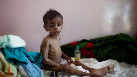 الأمم المتحدة: ملايين اليمنيين يتناولون وجبة غذائية واحدة كل يومين