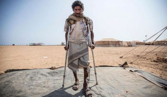 حروب الحوثي.. كارثة تخلّف 13% من اليمنيين لأوجاع الإعاقة