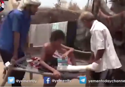 شاهد بالفيديو.. طفل يمني فقد أحد أقدامه بلغم حوثي