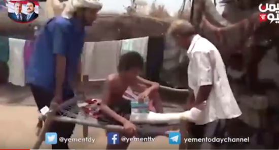 شاهد بالفيديو.. طفل يمني فقد أحد أقدامه بلغم حوثي