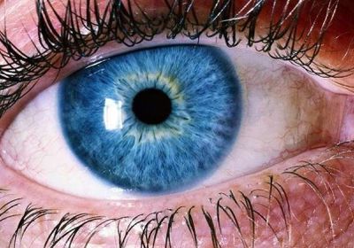 علماء يحذرون من زهري العيون المؤدي لفقدان البصر