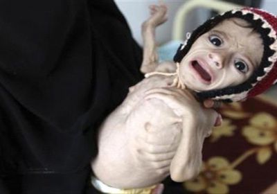 مقتل أكثر من 100 طفل يمني خلال 3 شهور فقط