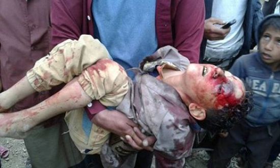 مقتل طفل برصاص قناص حوثي في تعز