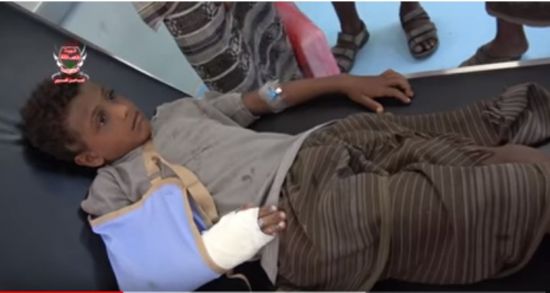 قناص حوثي يصيب طفل في منطقة الجاح بمديرية بيت الفقيه 