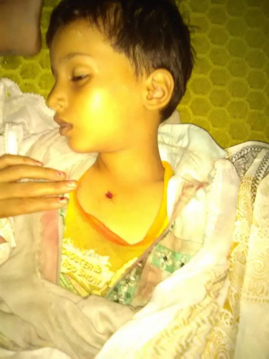 مقتل طفل برصاصة طائشة بمديرية دار سعد في عدن «صورة»