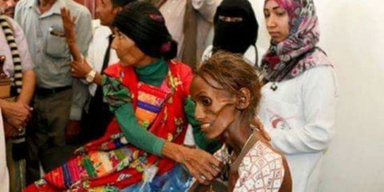 أرقام مفزعة في تقرير للأمم المتحدة بشأن المجاعة والبنزين والريال اليمني