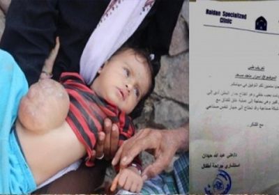 الإمارات تواصل دعمها لأطفال اليمن وتتكفل بعلاج الطفلة أسرار