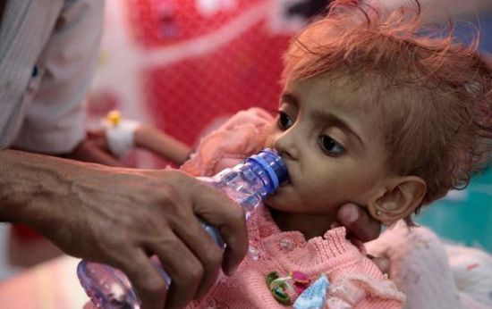 المدير الإقليمي ليونيسيف: أطفال اليمن يعيشون في "جحيم"