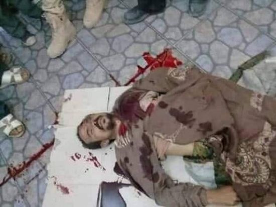 مقتل مشرف مليشيات الحوثي في الضالع
