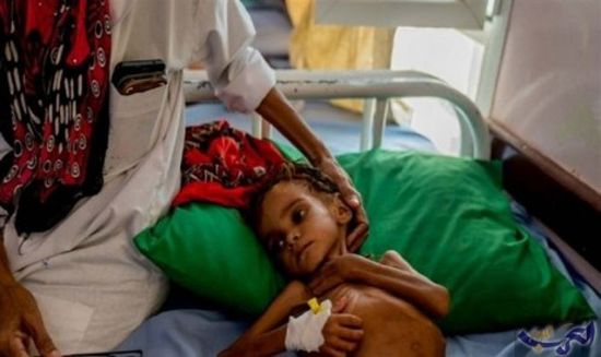 "بأي ذنب قتلت"..قصة مؤثرة لموت طفلة يمنية( فيديو) 