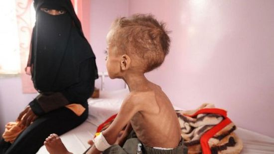 برنامج الأغذية العالمي: شبح المجاعة يهدد نصف سكان اليمن