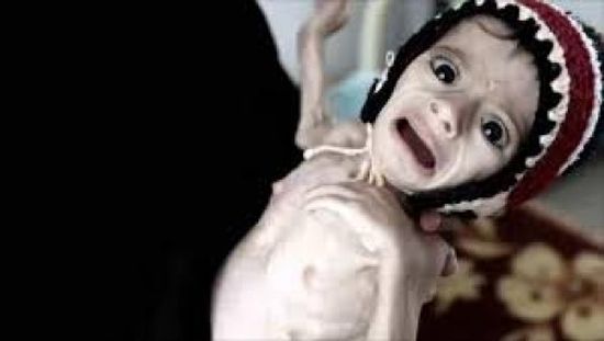 تفاديُا للمجاعة في اليمن ..الأمم المتحدة تطالب مجلس الأمن بإنهاء الصراع