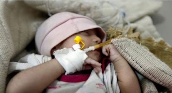 مليشيا الحوثي تقتحم قرية الأصابع وتنهب أدوية الكوليرا (تفاصيل)