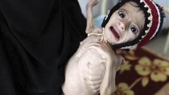 منظمات أممية تحذر من انعدام الأمن الغذائي باليمن